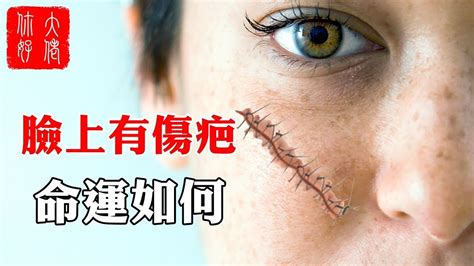 女人額頭有疤的運程圖|面相再好也沒用 臉上5處疤痕恐招來衰運